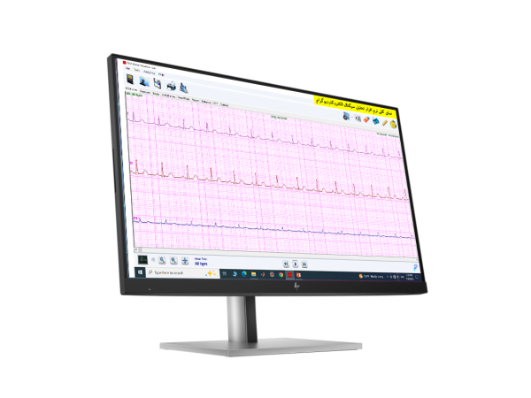 نرم افزار تحلیل الکتروکاردیوگرام