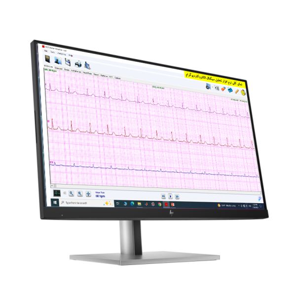 نرم افزار تحلیل آنلاین الکتروکاردیوگرام